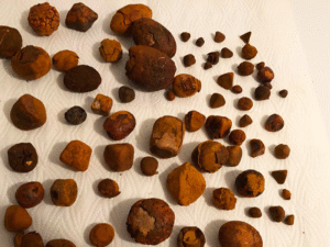 Ox Gallstones